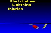 Electrical and Lightning Injuries. Electrical and Lightning Injuries : Lecture Outline ƒPhysics & pathophysiology of electrical injuries ƒRecognition,