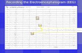 Recording the Electroencephalogram (EEG). Recording the EEG.