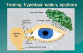 Tearing: hyperlacrimation, epiphora. Dry eye: tear break-up time, Schirmer test.