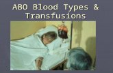 ABO Blood Types & Transfusions. Who can donate blood?