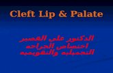 Cleft Lip & Palate الدكتور علي القصير اختصاص الجراحه التجميليه والتقويميه.