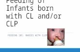 Feeding of Infants born with CL and/or CLP FEEDING 101: BABIES WITH CLEFTS.