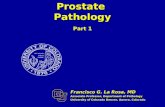 Prostate Pathology Part 1 Francisco G. La Rosa, MD Associate Professor, Department of Pathology University of Colorado Denver, Aurora, Colorado.