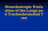 Bronchoscopic Evaluation of the Lungs and Tracheobronchial Tree.