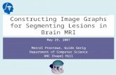 Constructing Image Graphs for Segmenting Lesions in Brain MRI May 29, 2007 Marcel Prastawa, Guido Gerig Department of Computer Science UNC Chapel Hill.