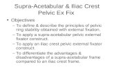 Supra-Acetabular & Iliac Crest Pelvic Ex Fix Objectives –To define & describe the principles of pelvic ring stability obtained with external fixation.