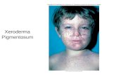 Xeroderma Pigmentosum. Study Guide/Outline--Mutations Mutation Mechanisms A gene may have a mutation rate of “1.4 x10 -5 ” What exactly does this number.