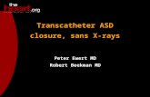 Transcatheter ASD closure, sans X-rays Peter Ewert MD Robert Beekman MD.