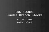 EKG ROUNDS Bundle Branch Blocks 07. 04. 2005 Nadim Lalani.