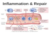 Inflammation & Repair. Chronic Inflammation Cell Types in Chronic Inflammation Macrophages Types of Macrophages (fixed) – Kupffer cells - liver –Pulmonary.