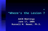 “Where’s the Lesion”? AACN Meetings June 17, 2005 Russell M. Bauer, Ph.D.