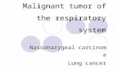 Malignant tumor of the respiratory system Nasopharygeal carcinoma Lung cancer.
