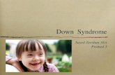 Down Syndrome Sayed Zeeshan Alvi Premed 3. What is it? Down syndrome, also known as Trisomy 21, is a genetic disorder that presents complications in a.