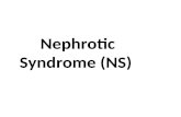 Nephrotic Syndrome (NS) Definition NS is an accumulation of symptoms and signs and is characterized by proteinuria, hypoproteinemia, edema, and hyperlipidemia.