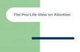 The Pro-Life View on Abortion. Religious Beliefs and Civil Rights.