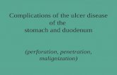 Complications of the ulcer disease of the stomach and duodenum (perforation, penetration, malignization)