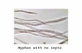 Hyphae with no septa. Pore Type within Septum Secreted Catalyst.