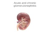 Acute and chronic glomerulonephritis. Glomerulonephritis Glomerulonephritis – heterogenic group of diseases with primary glomerular localization of pathological.