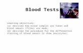 Blood Tests Learning objectives: (a) describe how blood samples are taken and blood smears (films) are made; (b) describe the procedure for the differential.