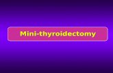 Mini-thyroidectomy. Minimally invasive thyroid surgery l Endoscopic thyroid surgery l Video-assisted thyroid surgery l Mini-thyroidectomy.