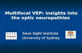 Multifocal VEP: insights into the optic neuropathies Save Sight Institute University of Sydney.