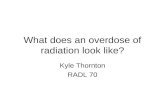 What does an overdose of radiation look like? Kyle Thornton RADL 70.