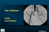 ICVWG 09-1 Iliac Disease: Core Curriculum. ICVWG 09-2 Iliac Disease Diagnosis Indications Technical Issues Treatment Options - PTA - Surgical Complications.