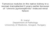 Tumorous nodules in the native kidney in a woman transplanted 3 years earlier because of “chronic pyelonephritis”-induced renal failure B. Ivanyi Department.