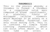 THROMBOSIS This is the process whereby a thrombus is formed. A thrombus is a coagulated solid mass composed of blood constituents, i.e. platelets, fibrin.