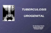 TUBERCULOSIS UROGENITAL Dr Domingo Pavón SERVICIO DE UROLOGIA HOSPITAL DE AGUDOS Dr ENRIQUE TORNU.