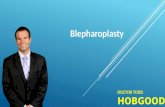 Blepharoplasty (Eyelid Surgery) at Scottsdale