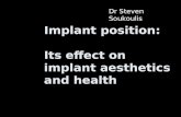 Implant position:  Its effect on implant aesthetics and health