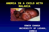 ANEMIA  IN A CHILD WITH MALARIA