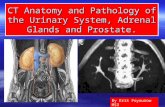 CT Anatomy and Pathology of the Urinary System, Adrenal Glands and Prostate.