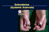 Scleroderma  ( Systemic Sclerosis )