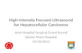 High-Intensity Focused Ultrasound for Hepatocellular Carcinoma