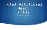 Total Artificial Heart (TAH)