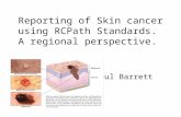 Reporting of Skin cancer using RCPath Standards.  A regional perspective.