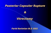 Posterior Capsular Rupture  &  Vitrectomy  Farid Karimian M.D 2002