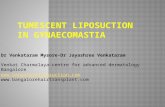 Tumescent  Liposuction in  Gynaecomastia