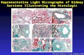 Representative Light Micrographs of Kidney Sections Illustrating the Histologic Scoring Criteria