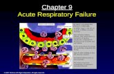 Chapter 9 Acute Respiratory Failure
