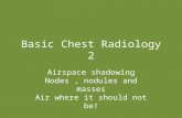 Basic Chest Radiology 2