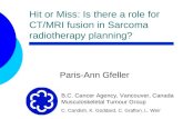 Hit or Miss: Is there a role for CT/MRI fusion in Sarcoma radiotherapy planning?