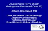 Unusual Optic Nerve Sheath Meningioma (Kennerdell Case 12)