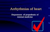 Arrhythmias of heart