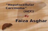 “Hepatocellular Carcinoma”                 (HCC)