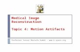 Medical Image Reconstruction Topic 4: Motion Artifacts
