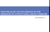 VENTRICULAR TACHYCARDIAS IN THE ABSENCE OF STRUCTURAL HEART DISEASE