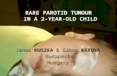 RARE PAROTID TUMOUR  IN A 2-YEAR -OLD CHILD